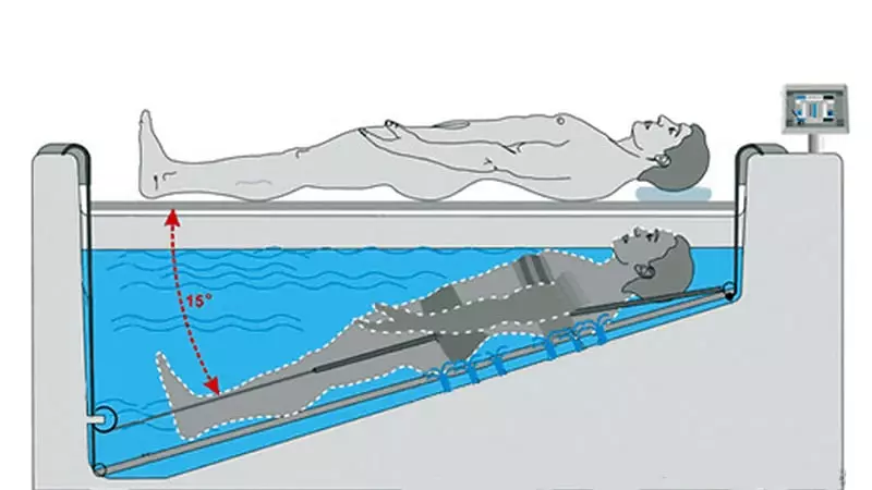 Radon Baths: Ábendingar og frábendingar