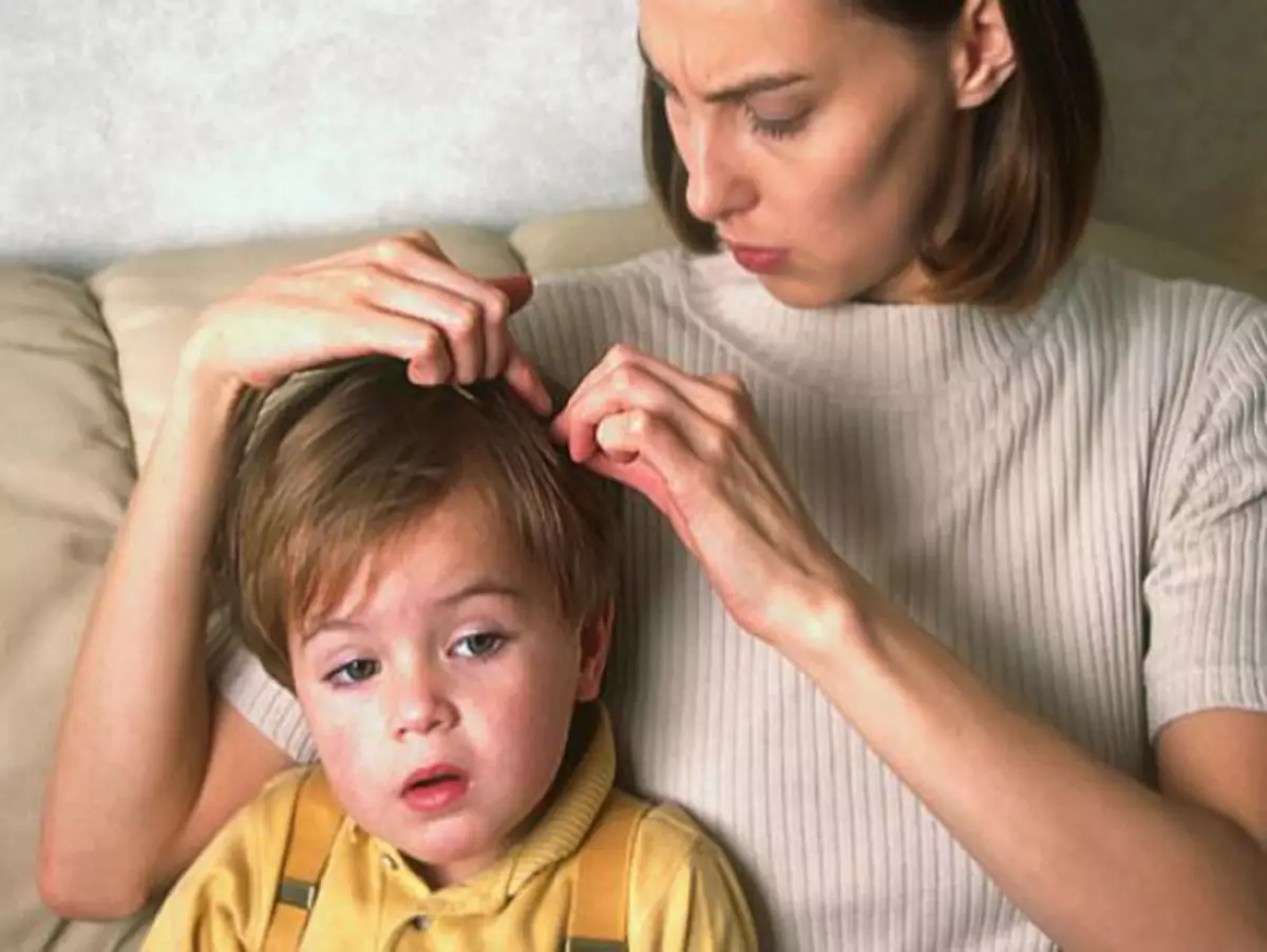 Kako dovesti uši i gnid kod kuće u djetetu i odraslih