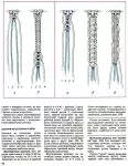 Кніга па макрамэ