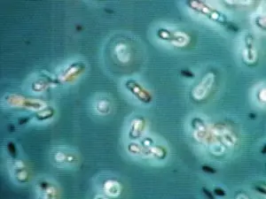 מהו חיידקים אנאירוביים וזיהומים אנאירוביים