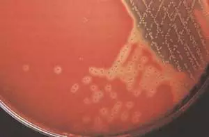 Wat is anaërobiese bakterieë en anaërobiese infeksies