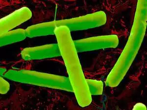 Wat is anaërobiese bakterieë en anaërobiese infeksies