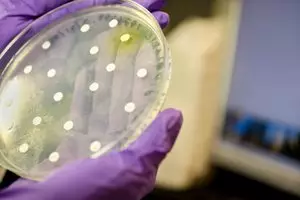 Ce este bacteriile anaerobe și infecțiile anaerobe